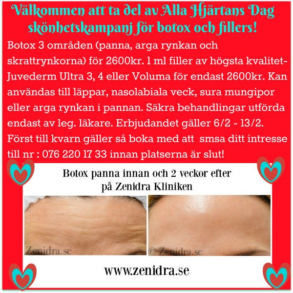 Botox Fillers erbjudande Malmö